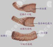 直肠炎的症状